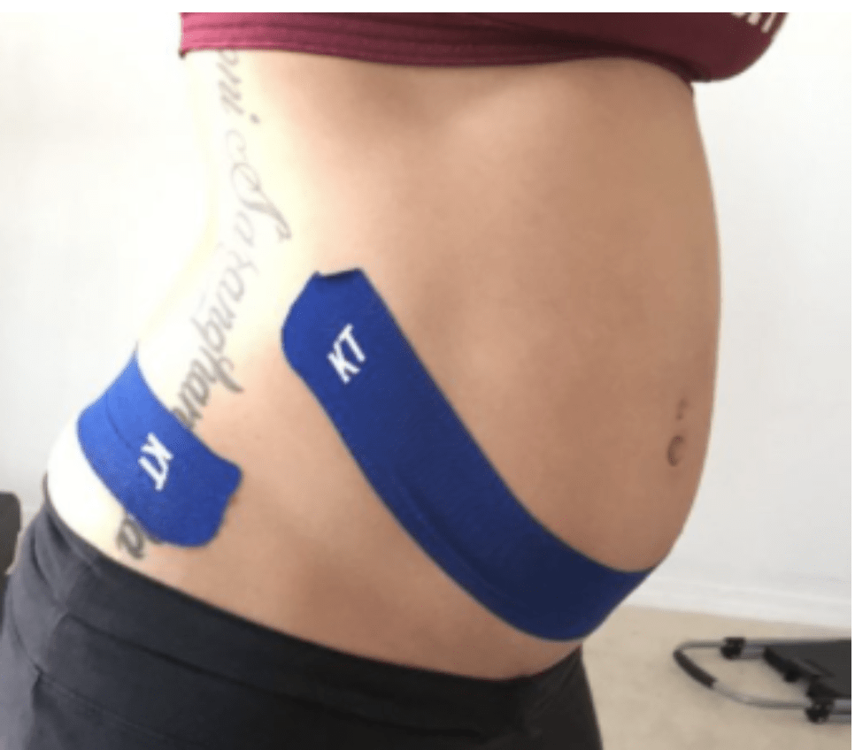 pregnant with Kinesio tape