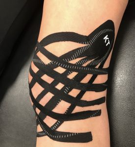 Image of a taped knee to convey the benefits of Kinseo taping - ProMetPT